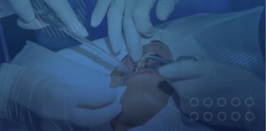 Extraction (surgical or impacted) / Wisdom Tooth